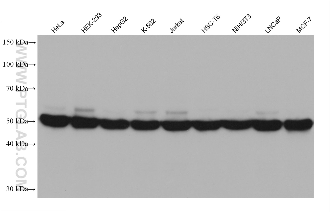 Western blot detection using RGAR501. Various lysates were subjected to SDS PAGE followed by western blot with 80713-1-RR (Beta Tubulin antibody) at dilution of 1:20000.
HRP-Goat Anti-Rabbit IgG Heavy Chain Specific Recombinant Secondary Antibody #RGA501 was used at 1:5000 for detection. Western blot detection using RGAR501. Various lysates were subjected to SDS PAGE followed by western blot with 80713-1-RR (Beta Tubulin antibody) at dilution of 1:20000.
HRP-Goat Anti-Rabbit IgG Heavy Chain Specific Recombinant Secondary Antibody #RGA501 was used at 1:5000 for detection.