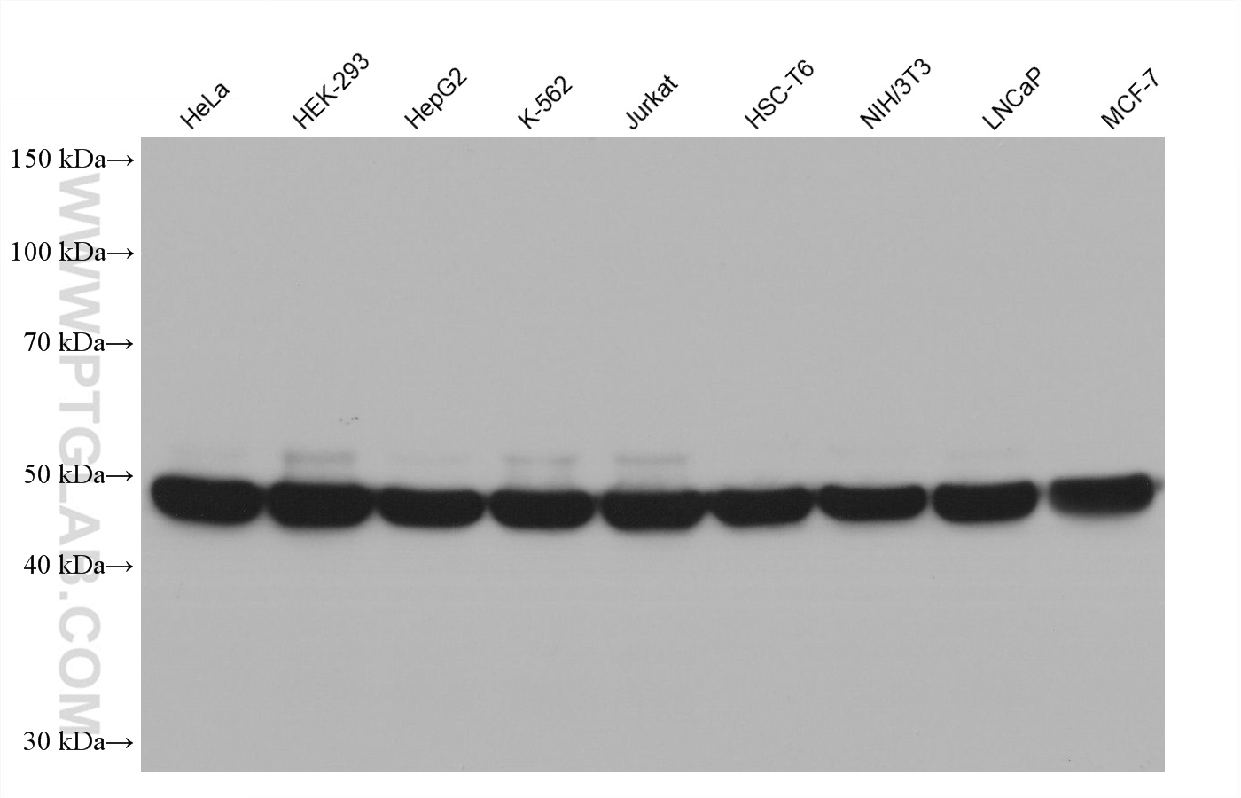 Western blot detection using RGAR501. Various lysates were subjected to SDS PAGE followed by western blot with 80713-1-RR (Beta Tubulin antibody) at dilution of 1:20000.
HRP-Goat Anti-Rabbit IgG Heavy Chain Specific Recombinant Secondary Antibody #RGA501 was used at 1:10000 for detection. Western blot detection using RGAR501. Various lysates were subjected to SDS PAGE followed by western blot with 80713-1-RR (Beta Tubulin antibody) at dilution of 1:20000.
HRP-Goat Anti-Rabbit IgG Heavy Chain Specific Recombinant Secondary Antibody #RGA501 was used at 1:10000 for detection.