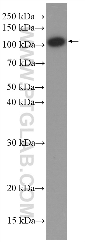 Jurkat cells were subjected to SDS PAGE followed by western blot with 17170-1-AP (IARS2 antibody) at dilution of 1:1000 incubated at room temperature for 1.5 hours. SA00001-7H (HRP-Mouse Anti-Rabbit IgG heavy Chain Specific antibody) as secondary antibody with dilution 1:15000.