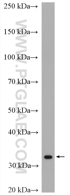 WB analysis of mouse brain using 11042-1-AP