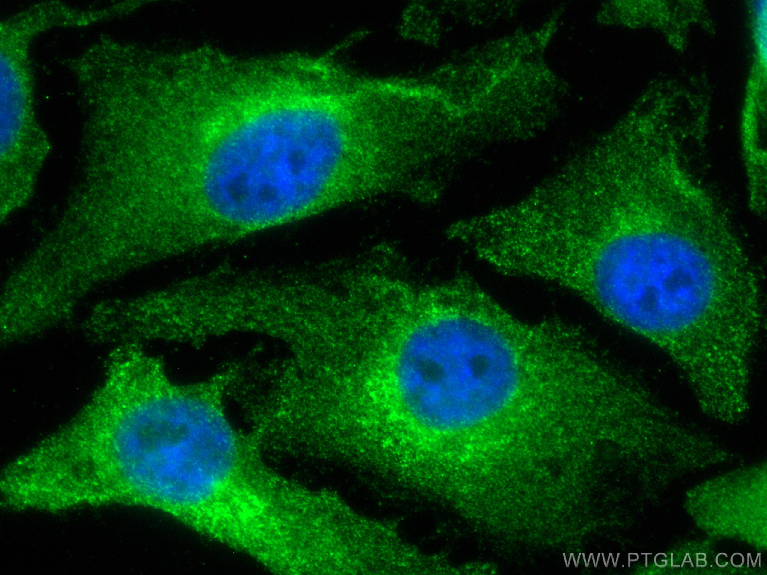 IF Staining of HeLa using 66585-1-Ig (same clone as 66585-1-PBS)