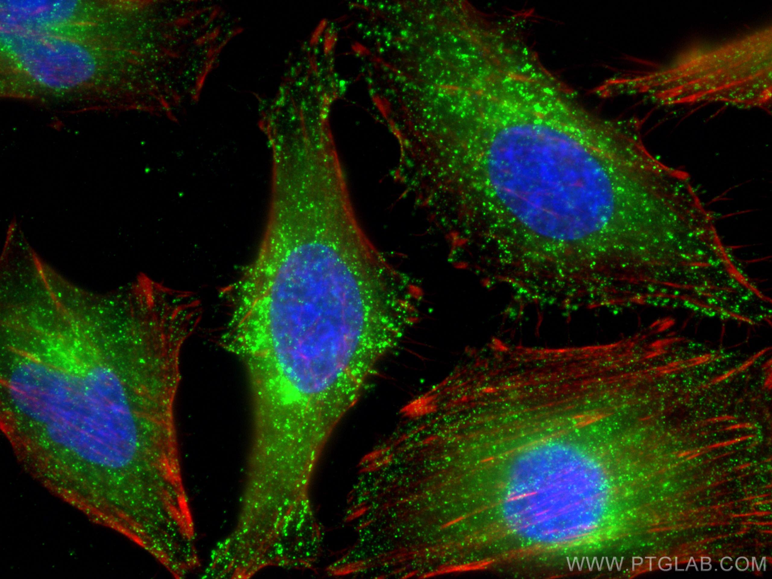 IF Staining of HeLa using 66585-1-Ig (same clone as 66585-1-PBS)