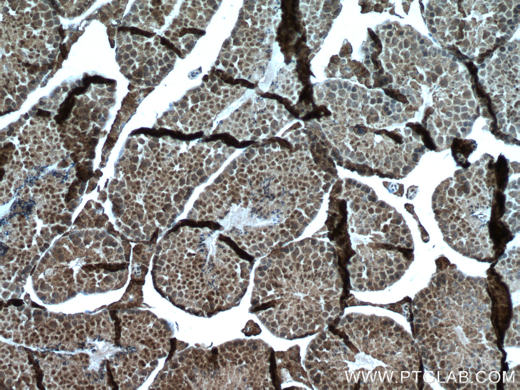 IHC staining of mouse testis using 66585-1-Ig (same clone as 66585-1-PBS)