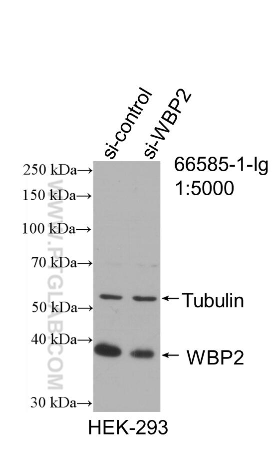 WB analysis of HEK-293 using 66585-1-Ig