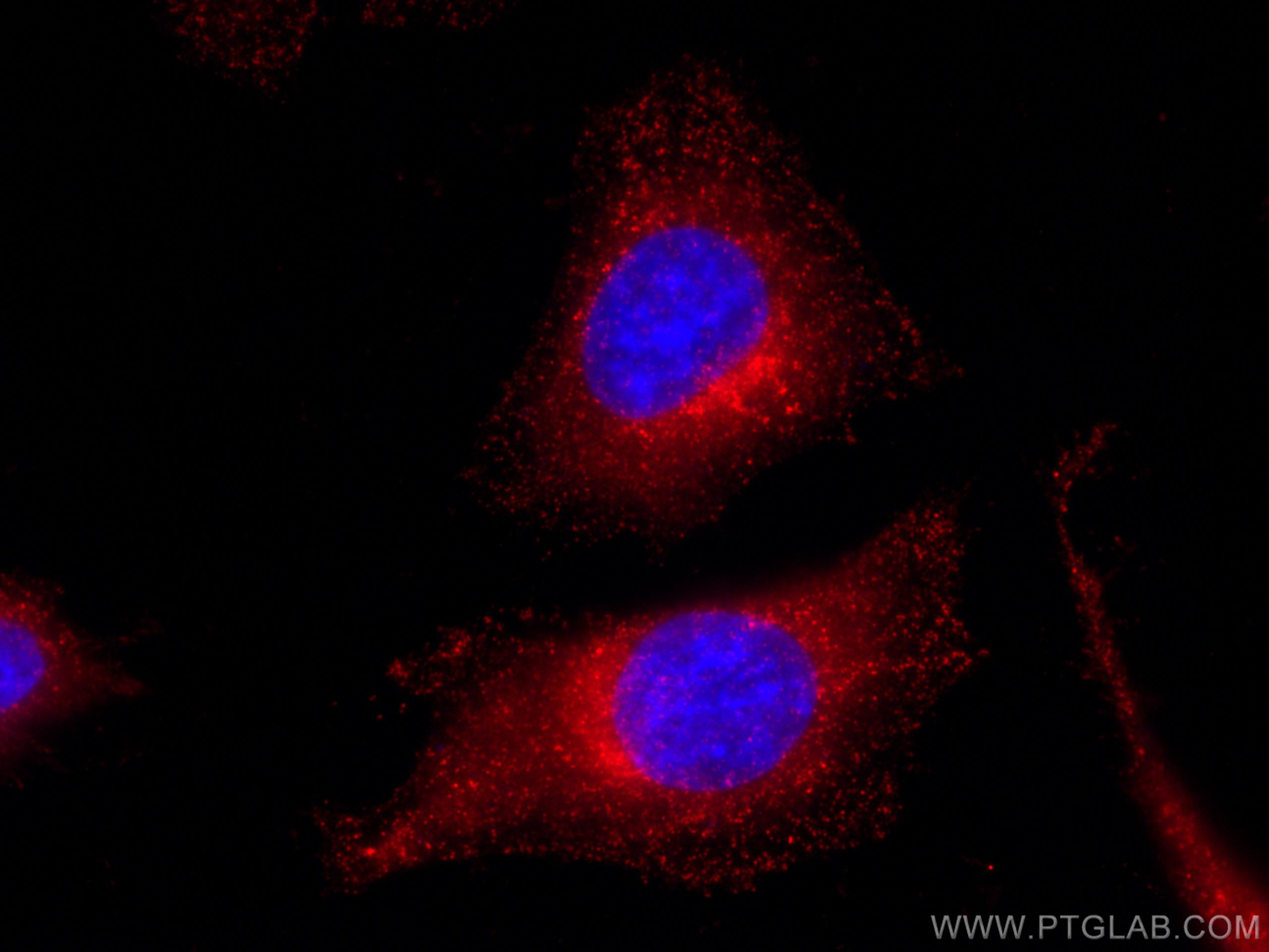 IF Staining of HeLa using CL594-66585