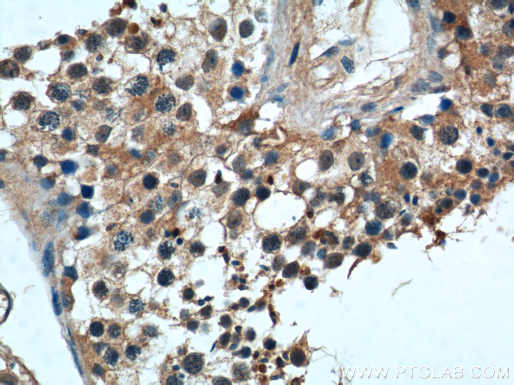 IHC staining of human testis using 22587-1-AP