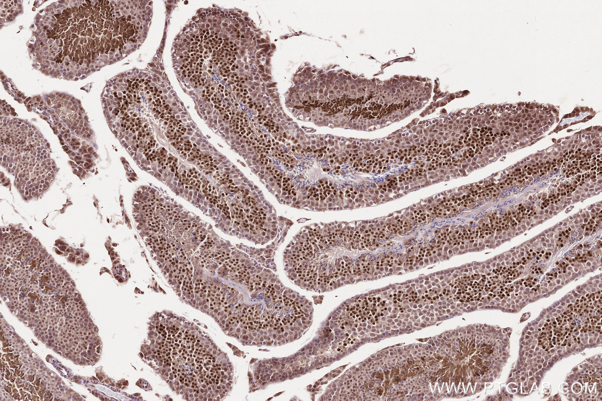 Immunohistochemical analysis of paraffin-embedded mouse testis tissue slide using 22587-1-AP (WBP2NL antibody) at dilution of 1:200 (under 10x lens). Heat mediated antigen retrieval with Tris-EDTA buffer (pH 9.0). IHC staining of mouse testis using 22587-1-AP