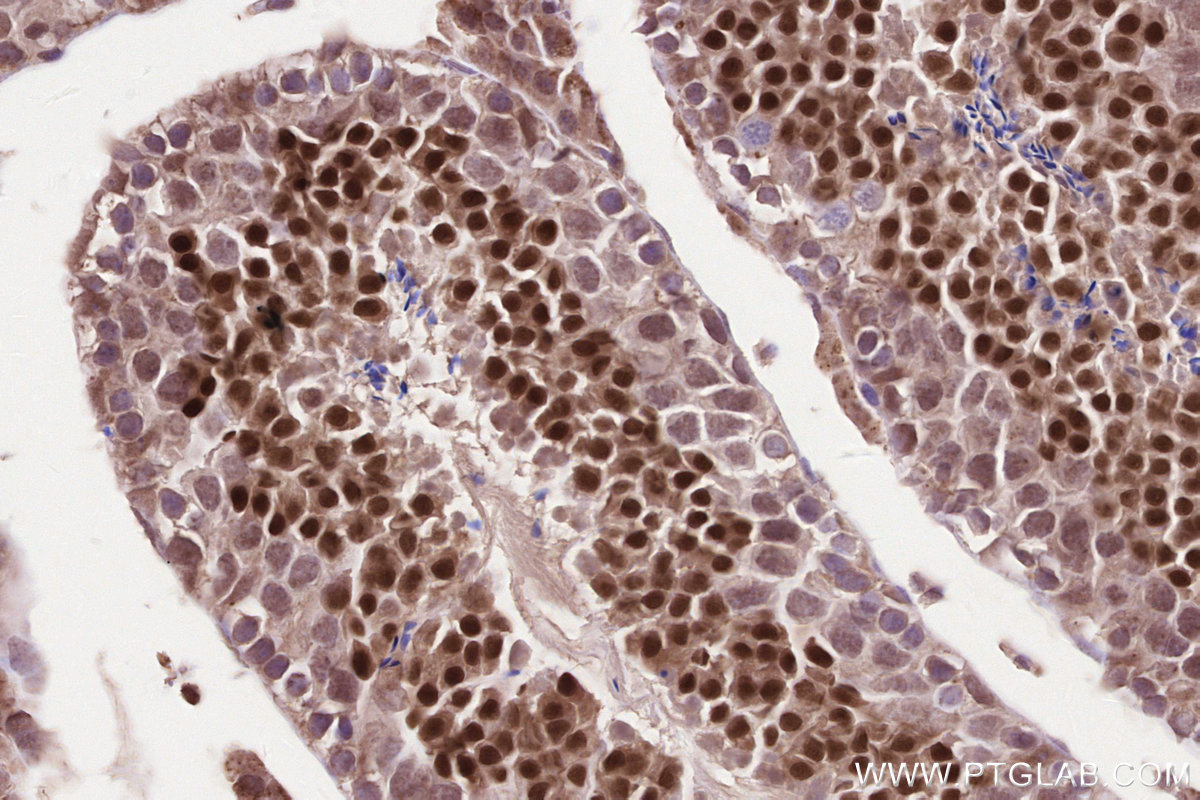 Immunohistochemical analysis of paraffin-embedded mouse testis tissue slide using 22587-1-AP (WBP2NL antibody) at dilution of 1:200 (under 40x lens). Heat mediated antigen retrieval with Tris-EDTA buffer (pH 9.0). IHC staining of mouse testis using 22587-1-AP