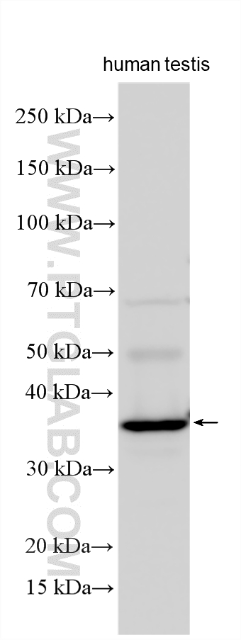 Human testis tissue were subjected to SDS PAGE followed by western blot with 22587-1-AP (WBP2NL antibody) at dilution of 1:1000 incubated at room temperature for 1.5 hours. WB analysis using 22587-1-AP