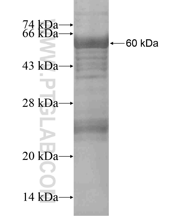 WBP2NL fusion protein Ag18293 SDS-PAGE WBP2NL fusion protein Ag18293 SDS-PAGE