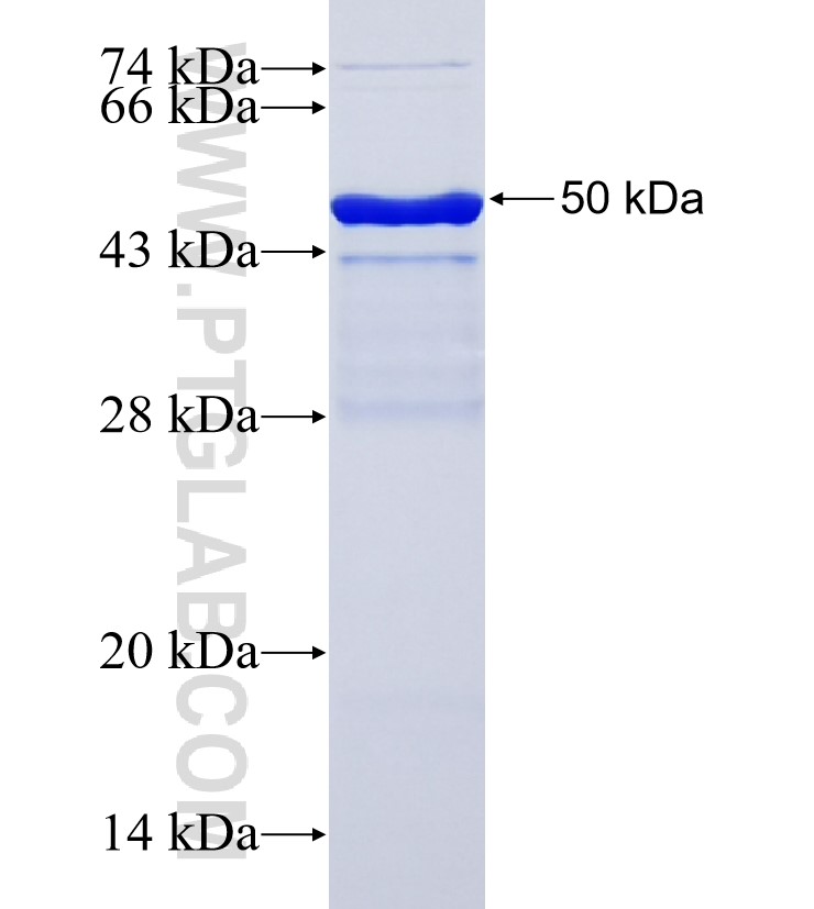 WBP4 fusion protein Ag35400 SDS-PAGE