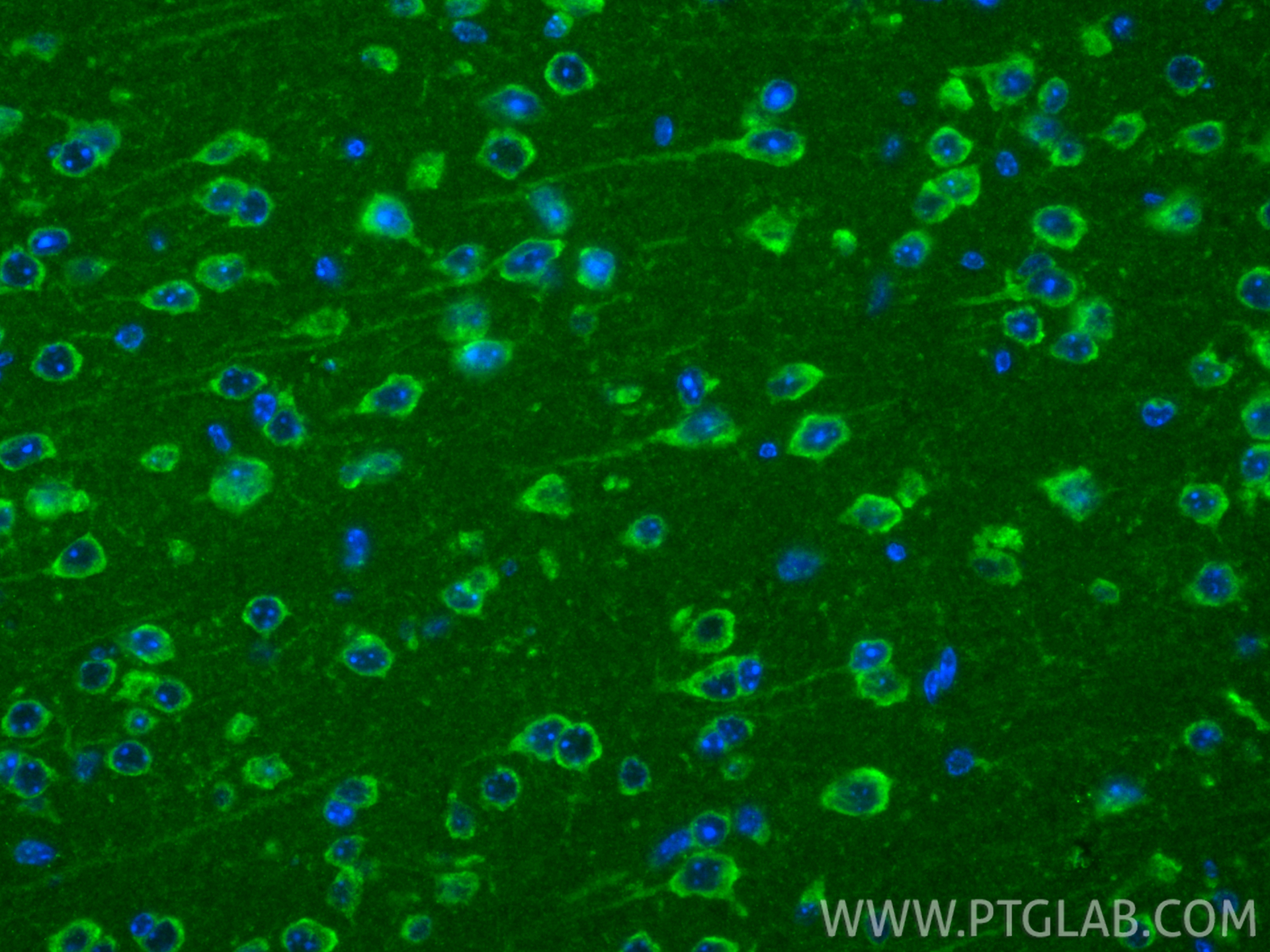 IF Staining of mouse brain using 13796-1-AP IF Staining of mouse brain using 13796-1-AP