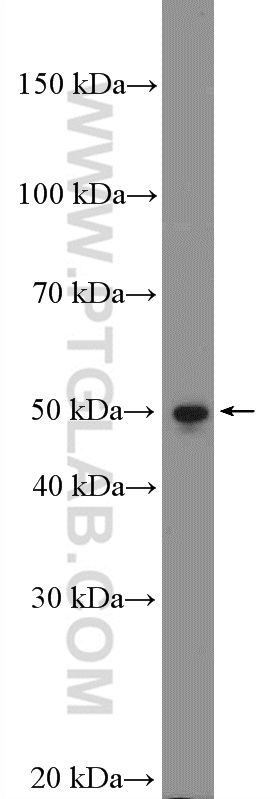 WB analysis of HeLa using 13796-1-AP