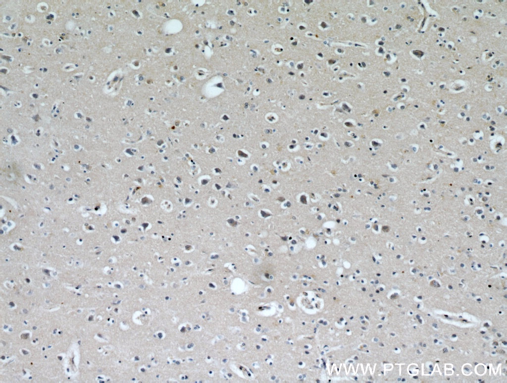 IHC staining of human brain using 21280-1-AP