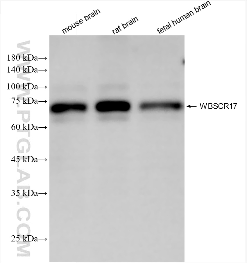 Various lysates were subjected to SDS PAGE followed by western blot with 86351-1-RR (WBSCR17 antibody) at dilution of 1:3000 incubated at room temperature for 1.5 hours. WB analysis using 86351-1-RR