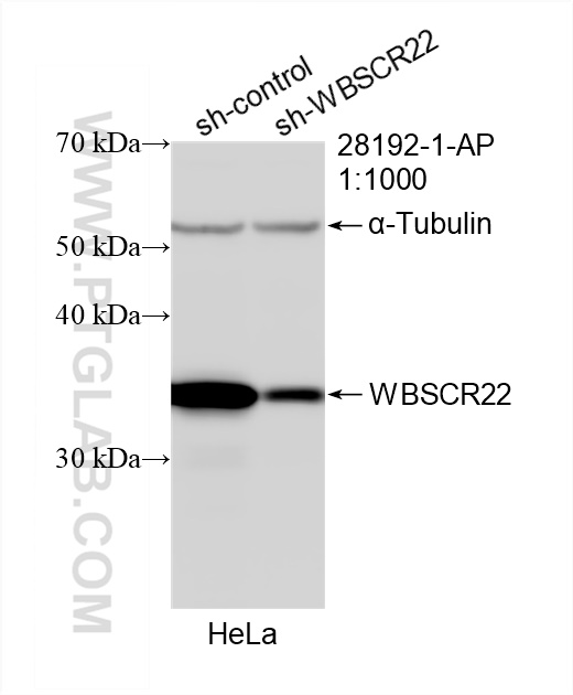 WB analysis of HeLa using 28192-1-AP