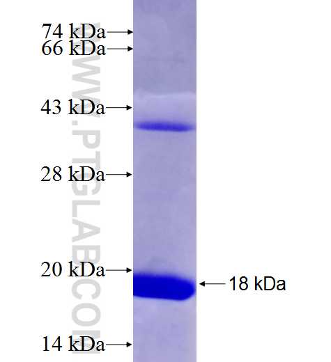 WBSCR22 fusion protein Ag28107 SDS-PAGE WBSCR22 fusion protein Ag28107 SDS-PAGE
