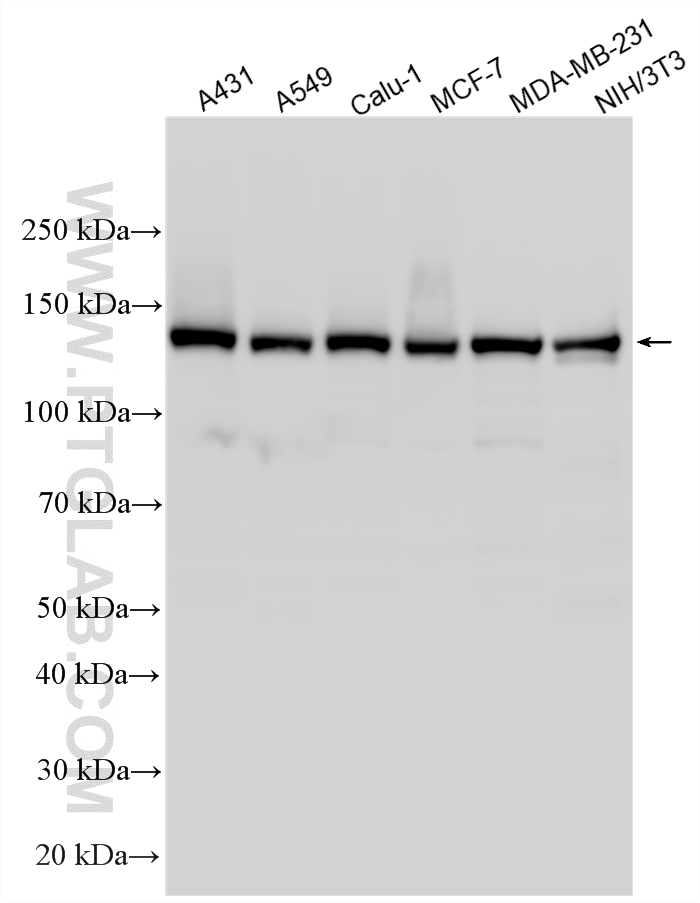 Various lysates were subjected to SDS PAGE followed by western blot with 33739-1-AP (WDHD1 antibody) at dilution of 1:20000 incubated at room temperature for 1.5 hours. WB analysis using 33739-1-AP