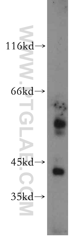 WB analysis of mouse lung using 20122-1-AP