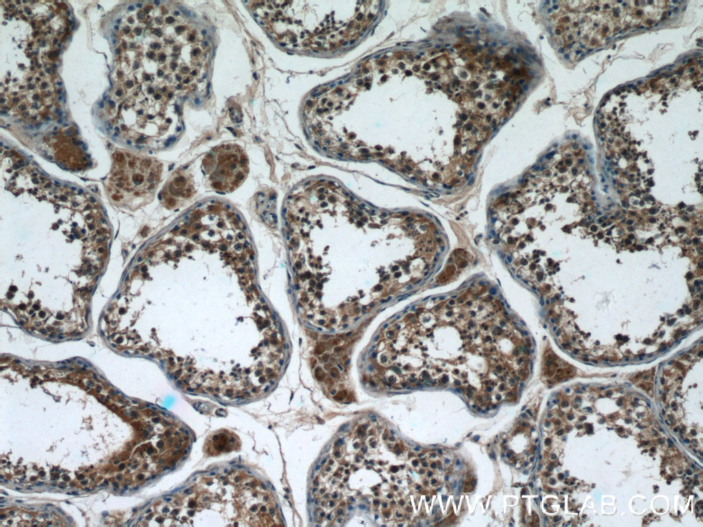 IHC staining of human testis using 12644-1-AP