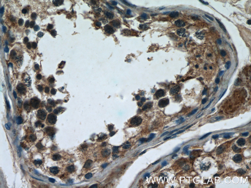 IHC staining of human testis using 12644-1-AP