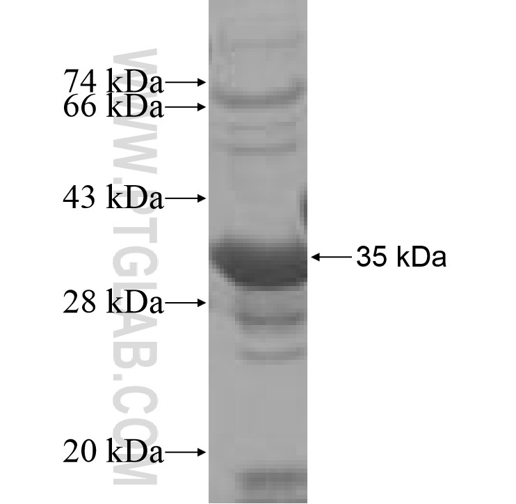 WDR18 fusion protein Ag7296 SDS-PAGE WDR18 fusion protein Ag7296 SDS-PAGE