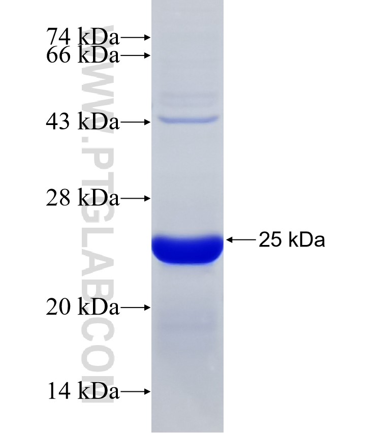 WDR23 fusion protein Ag31878 SDS-PAGE WDR23 fusion protein Ag31878 SDS-PAGE