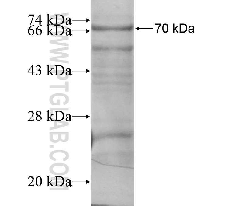WDR23 fusion protein Ag14769 SDS-PAGE WDR23 fusion protein Ag14769 SDS-PAGE
