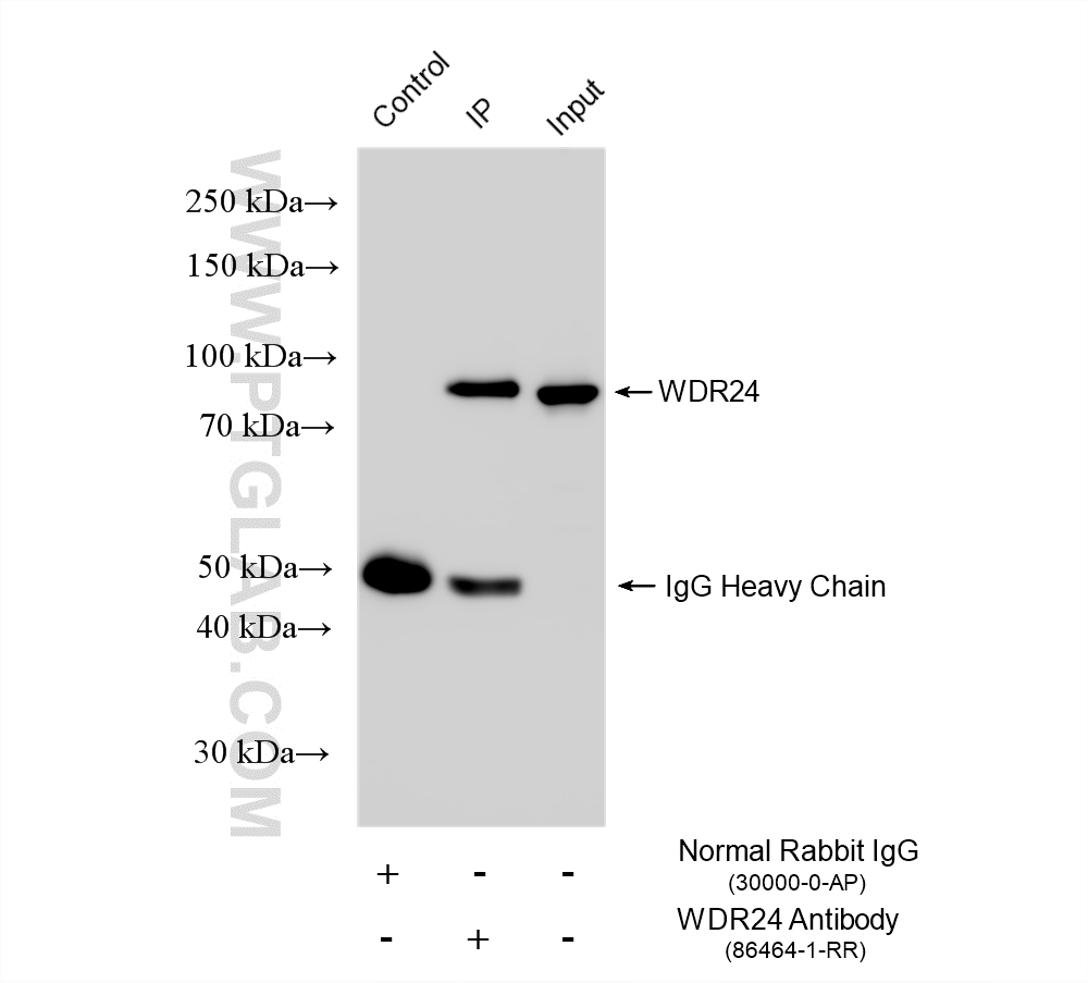 IP experiment of HEK-293 using 86464-1-RR IP experiment of HEK-293 using 86464-1-RR