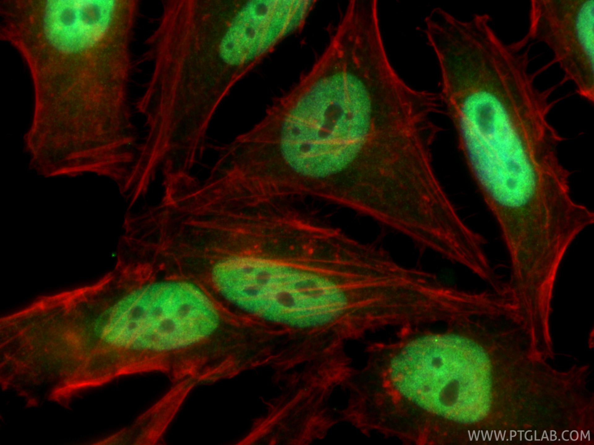 IF Staining of HeLa using 22614-1-AP IF Staining of HeLa using 22614-1-AP