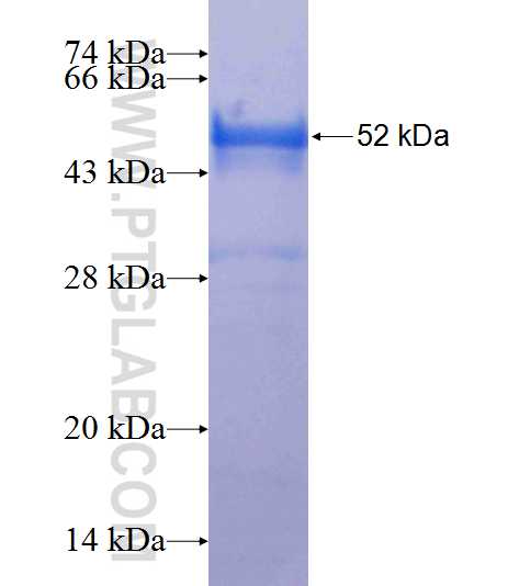 WDR35 fusion protein Ag24965 SDS-PAGE WDR35 fusion protein Ag24965 SDS-PAGE