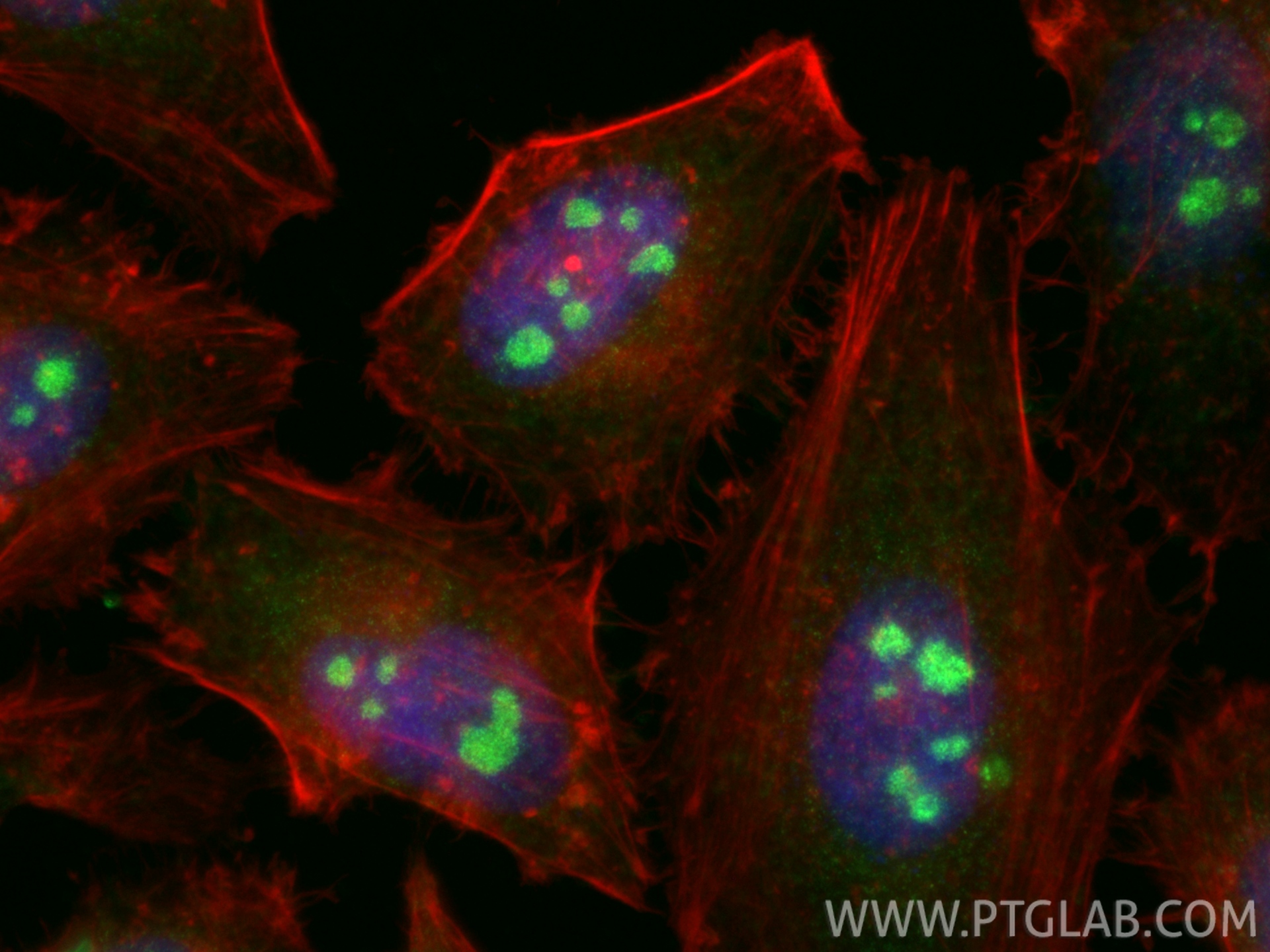 IF Staining of HeLa using 30227-1-AP