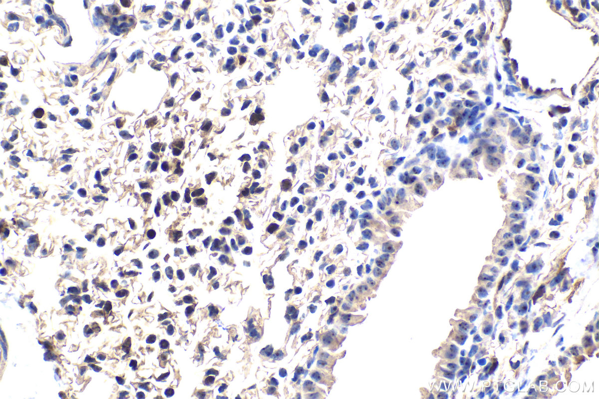 IHC staining of mouse lung using 30227-1-AP
