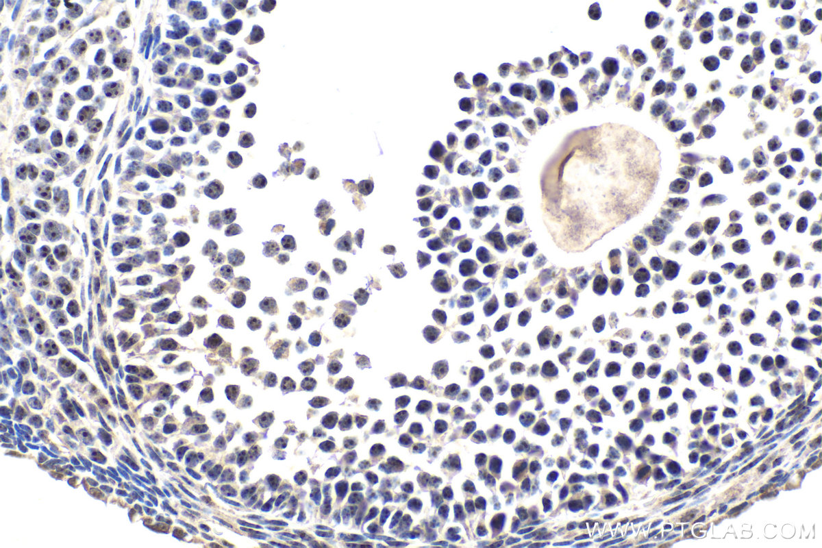 IHC staining of mouse ovary using 30227-1-AP