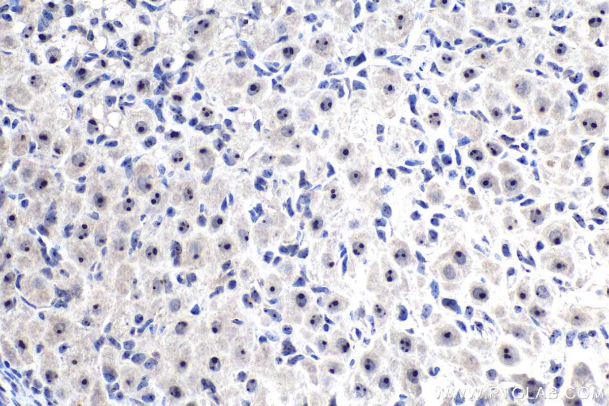 IHC staining of rat ovary using 30227-1-AP