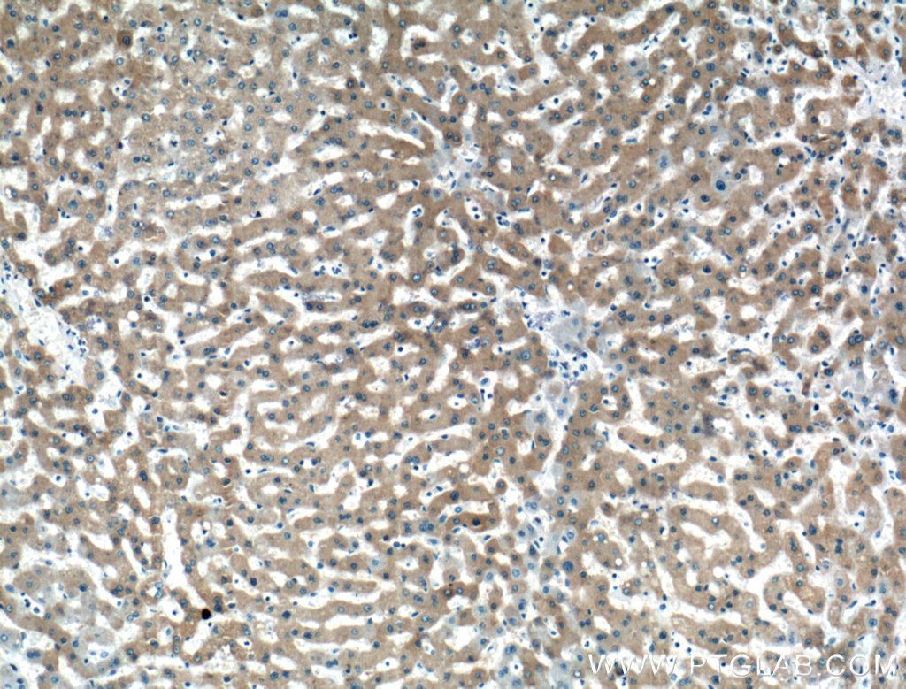 IHC staining of human liver using 19194-1-AP