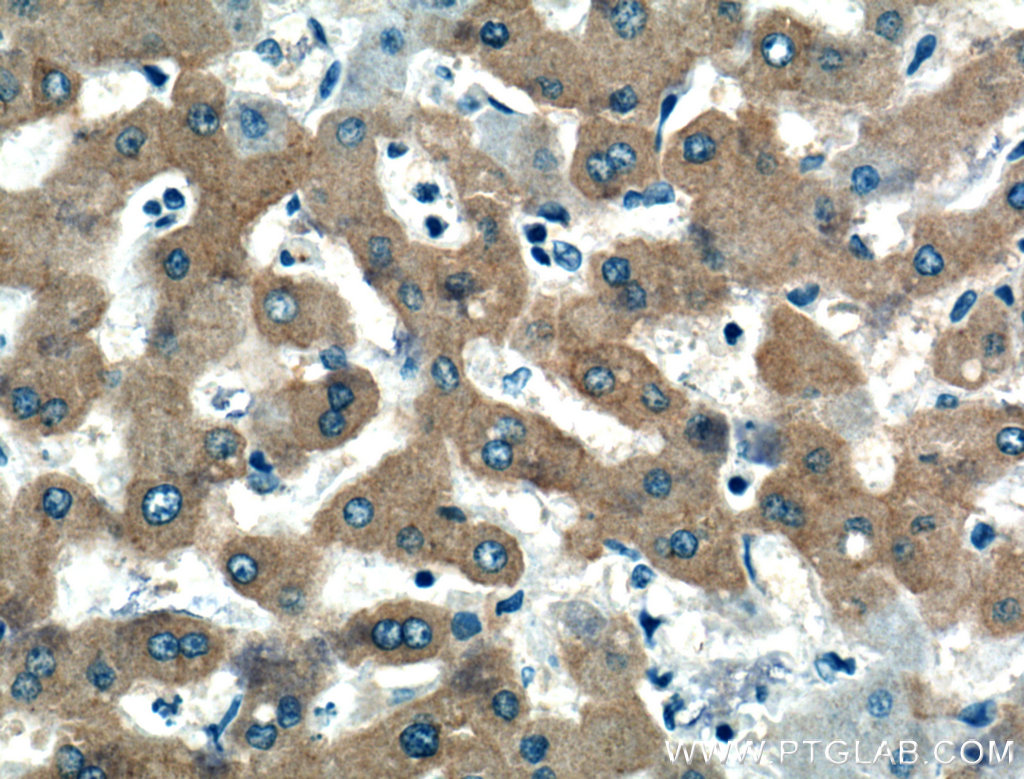 IHC staining of human liver using 19194-1-AP