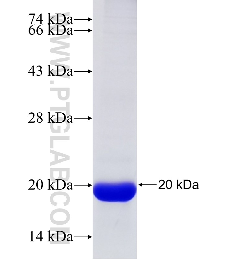 WDR45L fusion protein Ag32904 SDS-PAGE WDR45L fusion protein Ag32904 SDS-PAGE