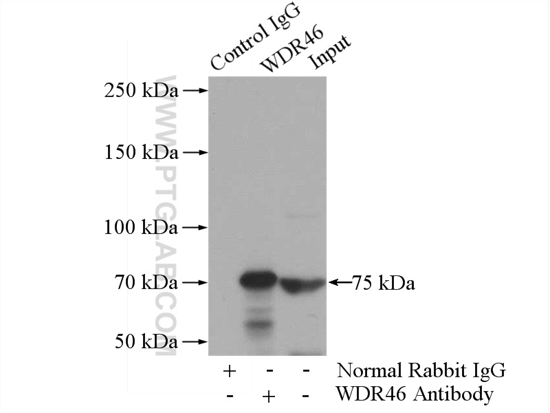 IP experiment of Jurkat using 15110-1-AP