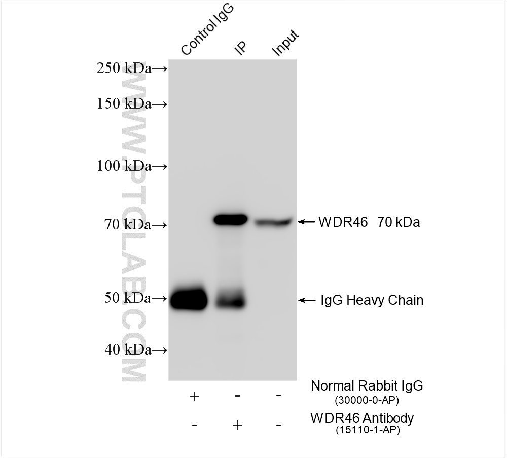 IP experiment of Jurkat using 15110-1-AP