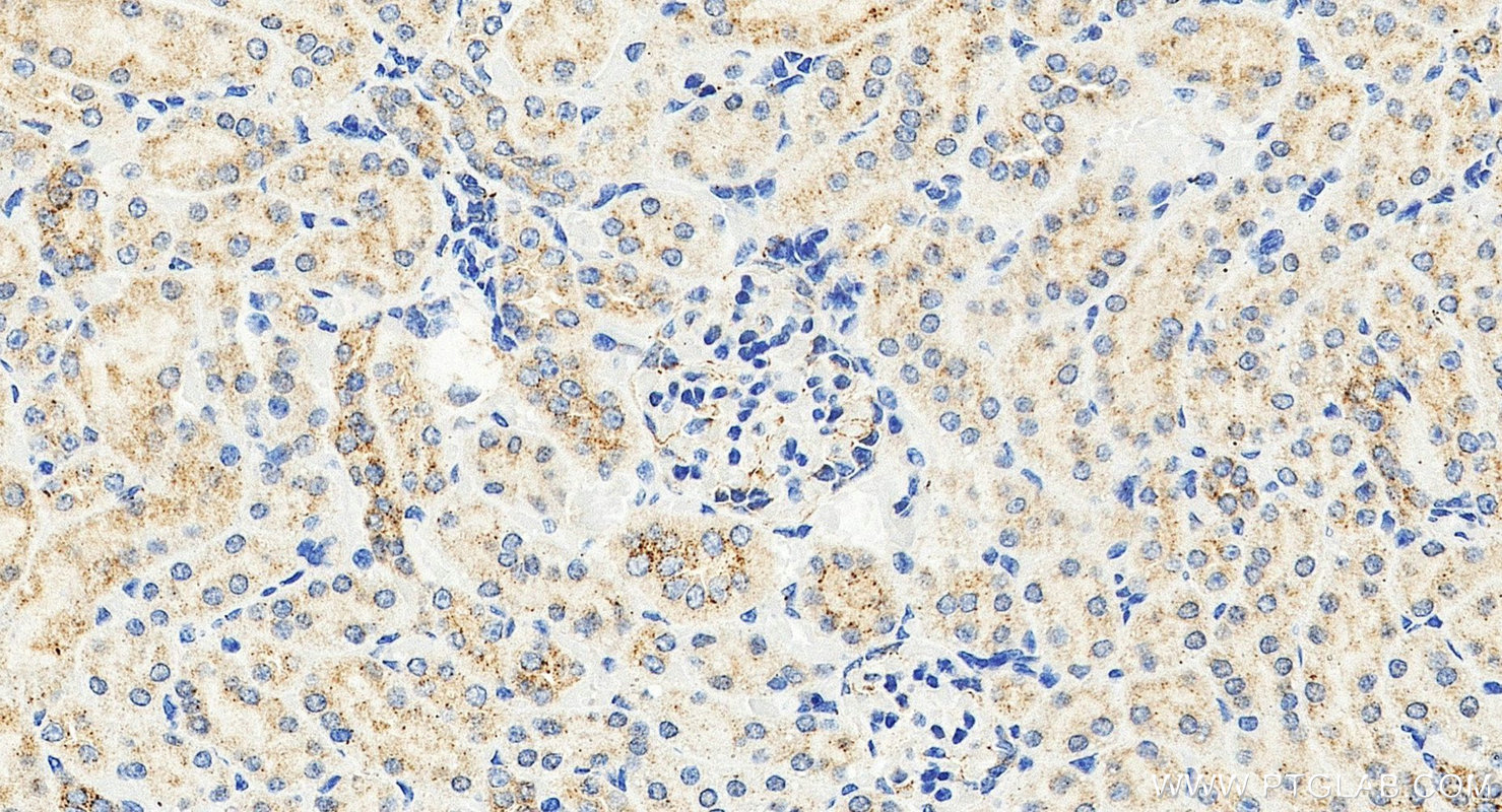 IHC staining of mouse kidney using 29364-1-AP IHC staining of mouse kidney using 29364-1-AP