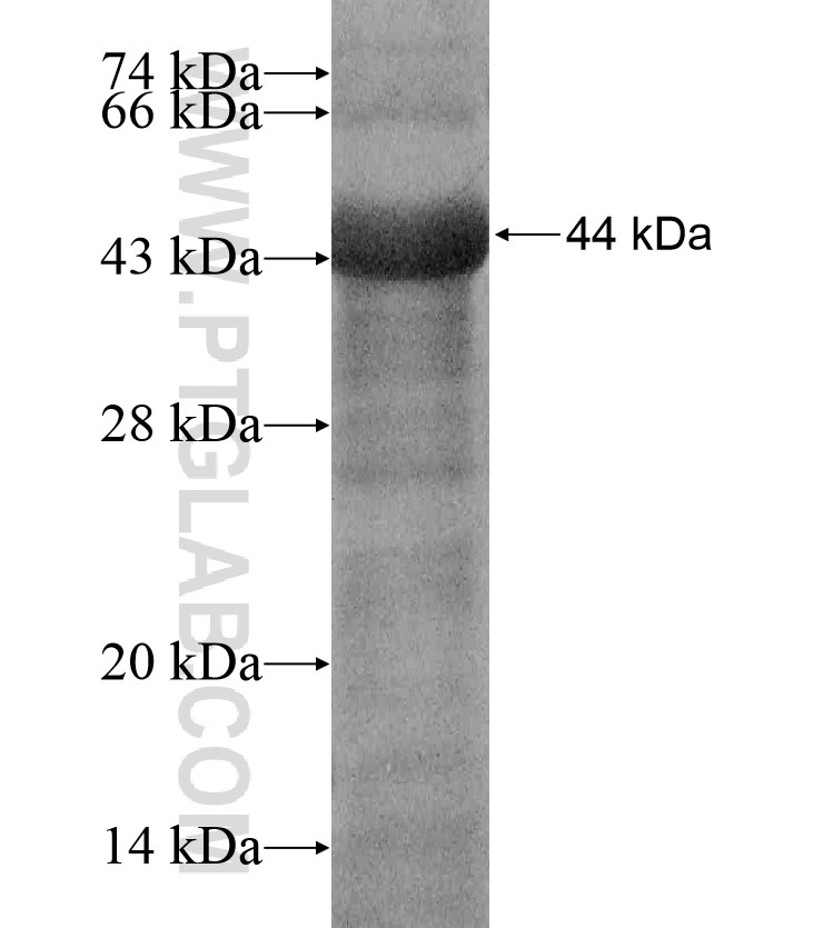 WDR49 fusion protein Ag17218 SDS-PAGE WDR49 fusion protein Ag17218 SDS-PAGE