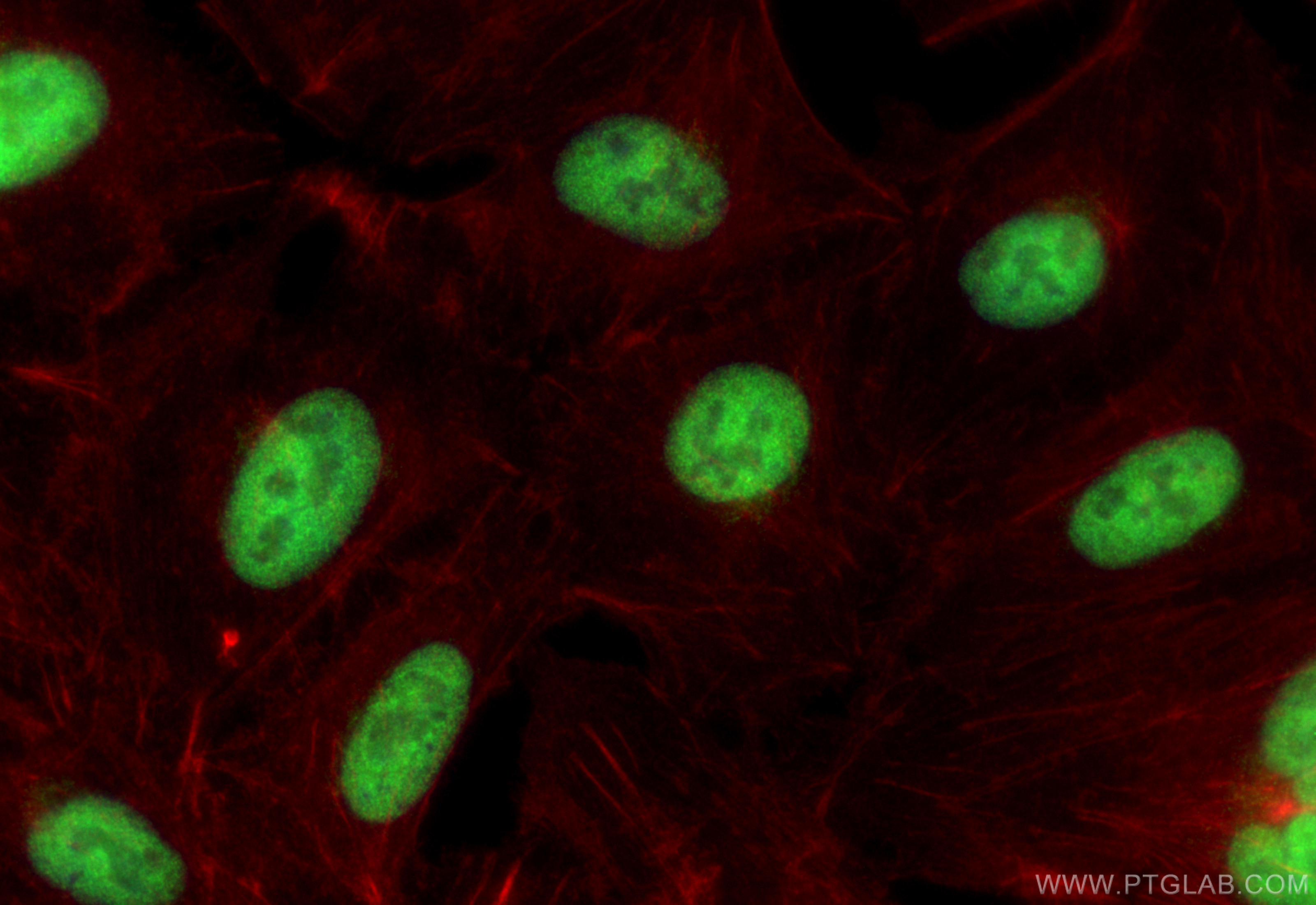 IF Staining of A549 using 15544-1-AP