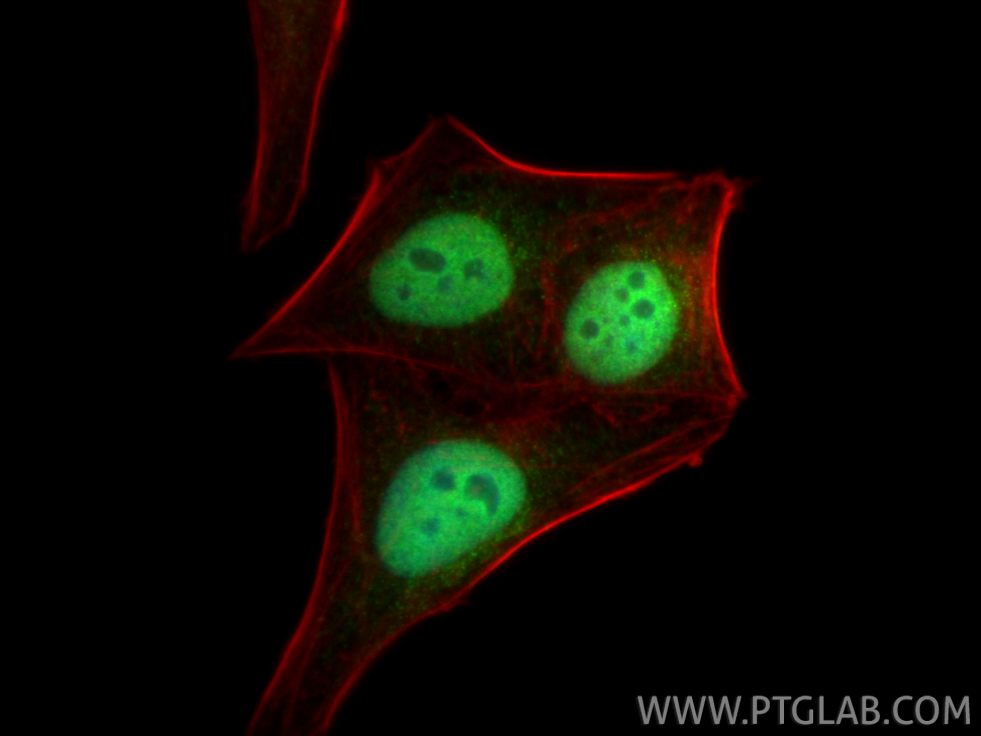 IF Staining of HepG2 using 15544-1-AP IF Staining of HepG2 using 15544-1-AP
