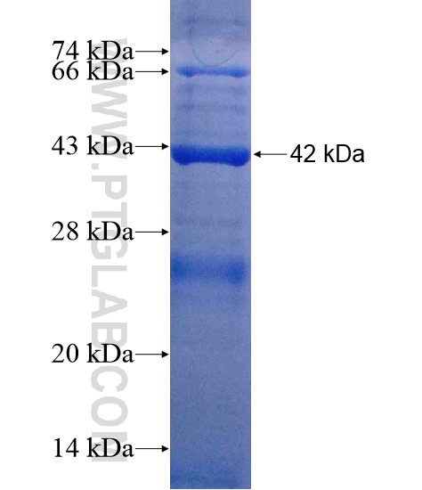 WDR51A fusion protein Ag20156 SDS-PAGE WDR51A fusion protein Ag20156 SDS-PAGE
