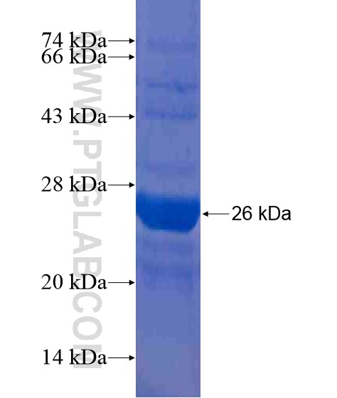 WDR51B fusion protein Ag20200 SDS-PAGE WDR51B fusion protein Ag20200 SDS-PAGE