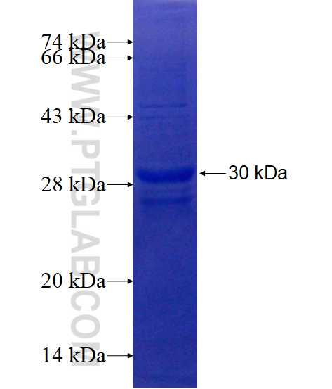 WDR55 fusion protein Ag14675 SDS-PAGE WDR55 fusion protein Ag14675 SDS-PAGE