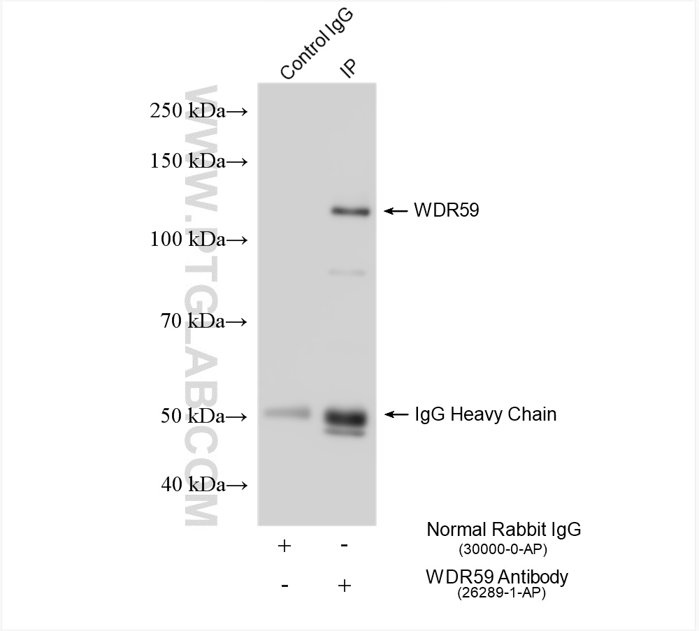 IP experiment of mouse brain using 26289-1-AP