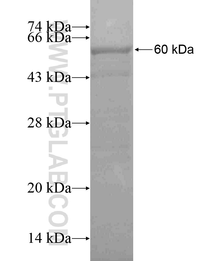 WDR61 fusion protein Ag18215 SDS-PAGE WDR61 fusion protein Ag18215 SDS-PAGE