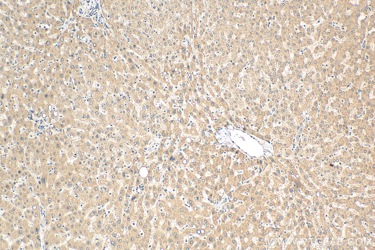 IHC staining of human liver using 24431-1-AP